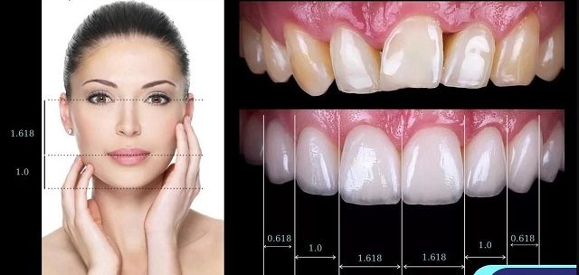 Độ hài hòa của răng được cân chỉnh tỉ mỉ từng chi tiết