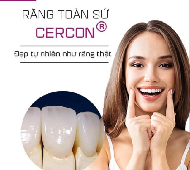 Răng toàn sứ Cercon HT
