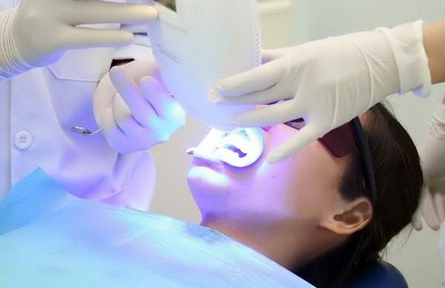 Nha khoa Iris Dental sự lựa chọn hàng đầu cho nụ cười xinh 