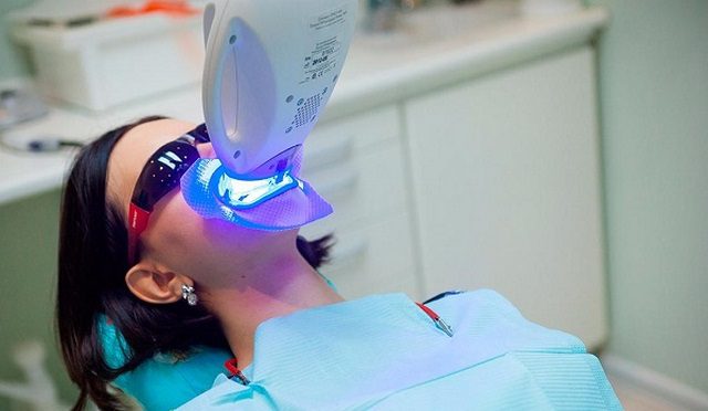 Tẩy trắng răng bằng công nghệ Bleach Bright mang tới hiệu quả vượt trội 